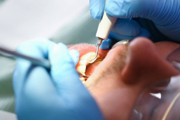 Best Emergency Dental Services for Seniors in Hawaiian Gardens, CA